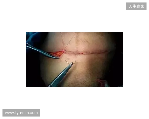 广州豹官方：杨浩眉弓伤口缝合30余针，预计5-7天后拆线